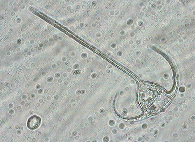 Dictyocha speculum